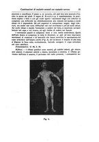 giornale/NAP0160688/1915-1916/unico/00000043