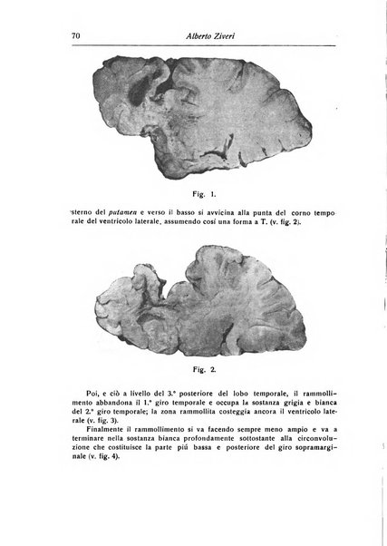 Annali di nevrologia