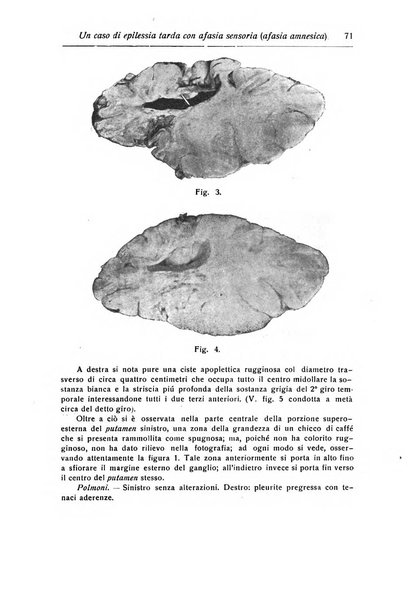 Annali di nevrologia