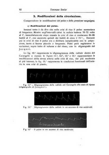 Annali di nevrologia