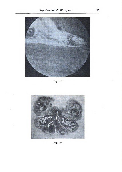 Annali di nevrologia