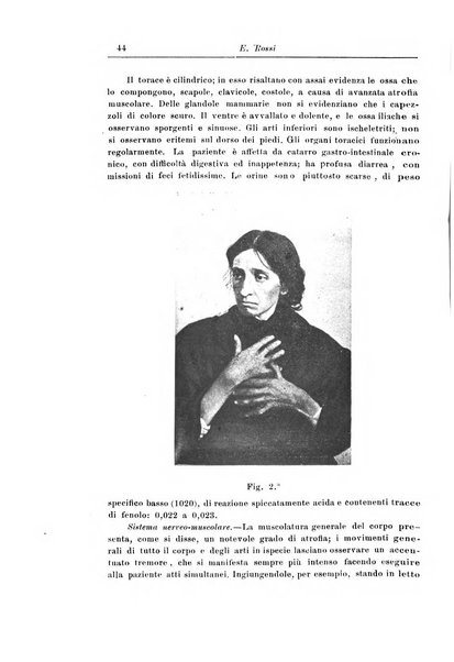 Annali di nevrologia