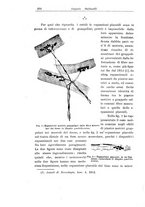 giornale/NAP0160688/1922/unico/00000264