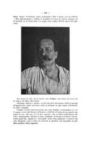 giornale/PAL0088016/1914/unico/00000193