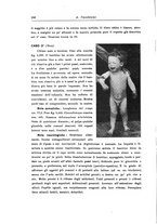 giornale/PUV0026701/1935/unico/00000166