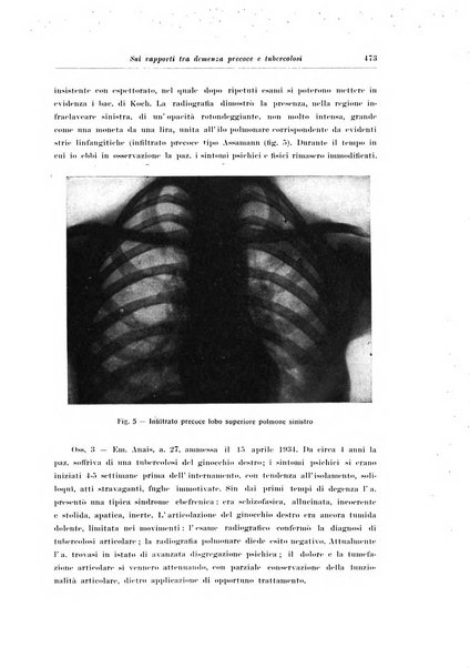 Note e riviste di psichiatria Manicomio provinciale di Pesaro