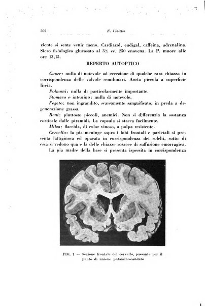 Note e riviste di psichiatria Manicomio provinciale di Pesaro