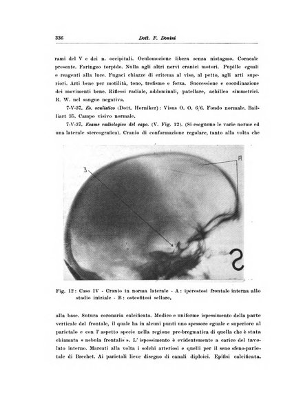 Note e riviste di psichiatria Manicomio provinciale di Pesaro