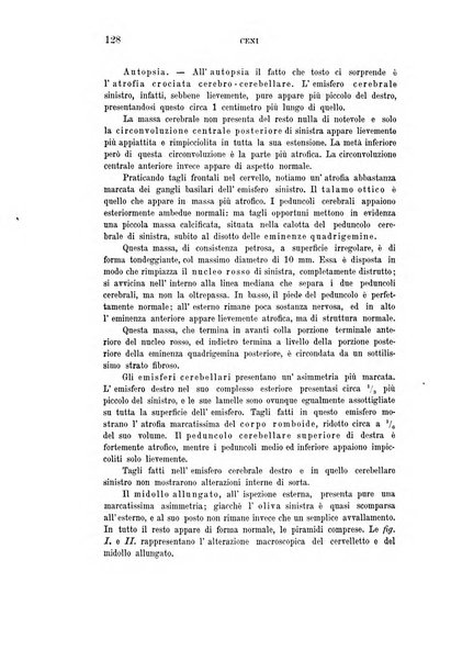 Rivista sperimentale di freniatria e medicina legale delle alienazioni mentali organo della Società freniatrica italiana