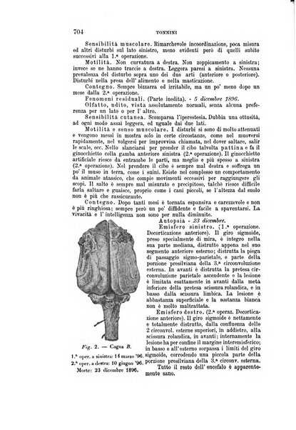 Rivista sperimentale di freniatria e medicina legale delle alienazioni mentali organo della Società freniatrica italiana