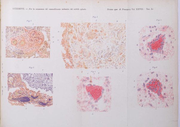 Rivista sperimentale di freniatria e medicina legale delle alienazioni mentali organo della Società freniatrica italiana