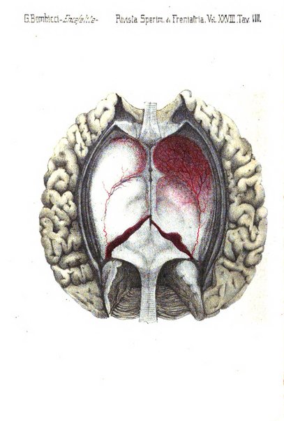 Rivista sperimentale di freniatria e medicina legale delle alienazioni mentali organo della Società freniatrica italiana