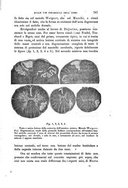 Rivista sperimentale di freniatria e medicina legale delle alienazioni mentali organo della Società freniatrica italiana