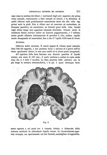 Rivista sperimentale di freniatria e medicina legale delle alienazioni mentali organo della Società freniatrica italiana