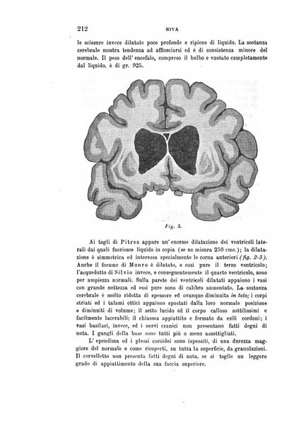 Rivista sperimentale di freniatria e medicina legale delle alienazioni mentali organo della Società freniatrica italiana