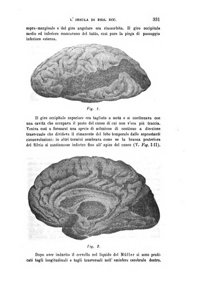 Rivista sperimentale di freniatria e medicina legale delle alienazioni mentali organo della Società freniatrica italiana