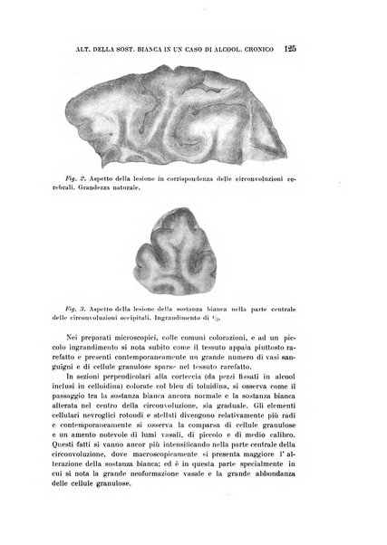 Rivista sperimentale di freniatria e medicina legale delle alienazioni mentali organo della Società freniatrica italiana