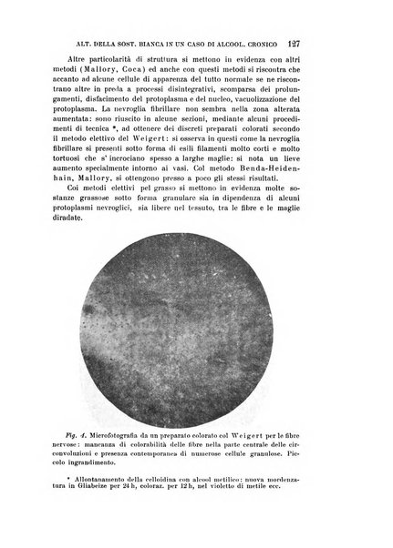 Rivista sperimentale di freniatria e medicina legale delle alienazioni mentali organo della Società freniatrica italiana