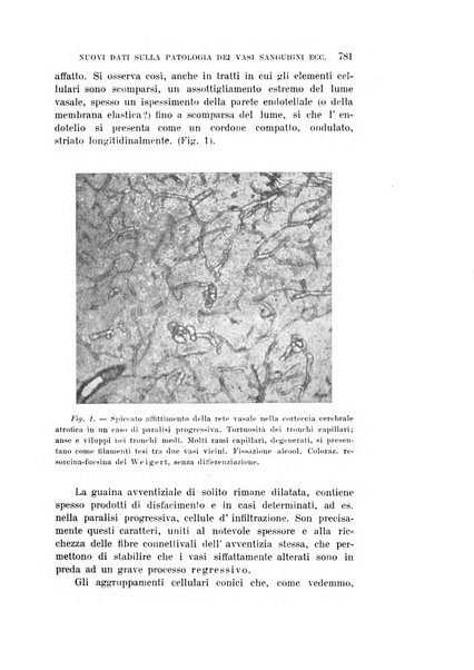 Rivista sperimentale di freniatria e medicina legale delle alienazioni mentali organo della Società freniatrica italiana