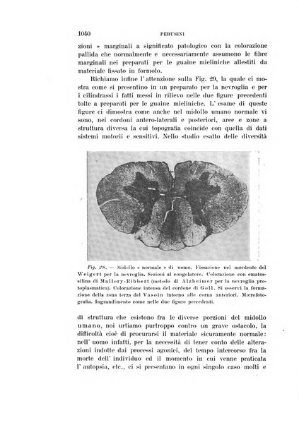 Rivista sperimentale di freniatria e medicina legale delle alienazioni mentali organo della Società freniatrica italiana