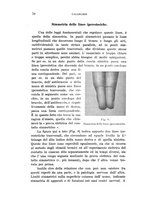 giornale/PUV0028278/1913/unico/00000088