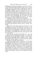 giornale/PUV0028278/1913/unico/00000195