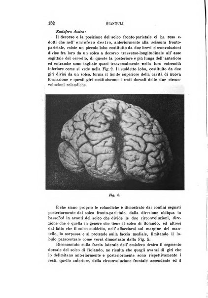 Rivista sperimentale di freniatria e medicina legale delle alienazioni mentali organo della Società freniatrica italiana