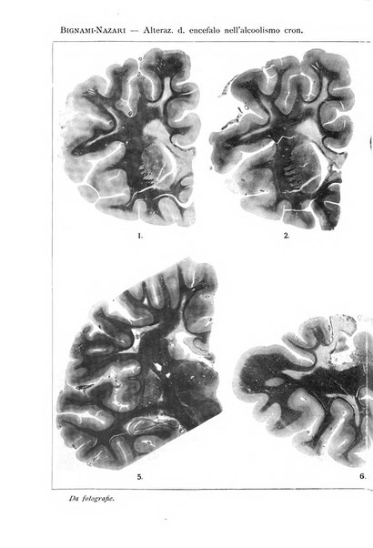 Rivista sperimentale di freniatria e medicina legale delle alienazioni mentali organo della Società freniatrica italiana