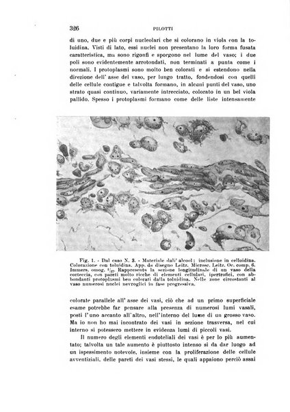 Rivista sperimentale di freniatria e medicina legale delle alienazioni mentali organo della Società freniatrica italiana