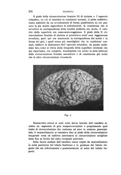 Rivista sperimentale di freniatria e medicina legale delle alienazioni mentali organo della Società freniatrica italiana