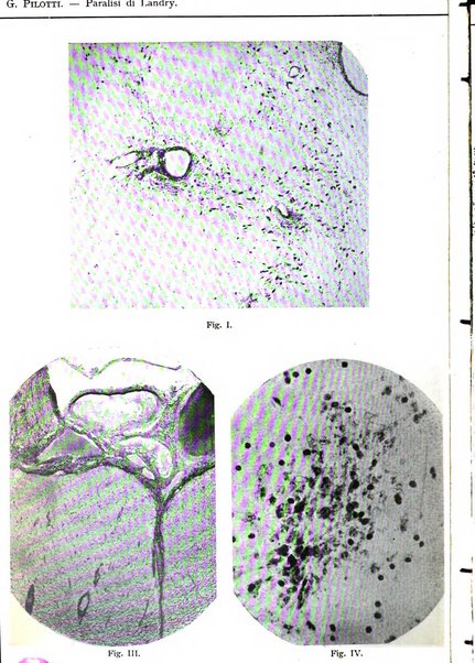 Rivista sperimentale di freniatria e medicina legale delle alienazioni mentali organo della Società freniatrica italiana