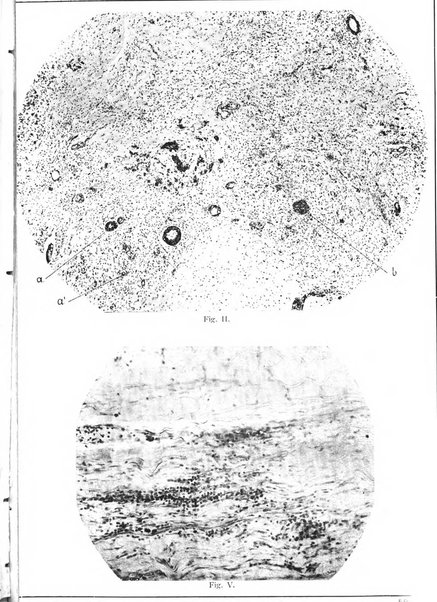 Rivista sperimentale di freniatria e medicina legale delle alienazioni mentali organo della Società freniatrica italiana