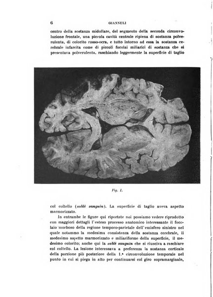 Rivista sperimentale di freniatria e medicina legale delle alienazioni mentali organo della Società freniatrica italiana