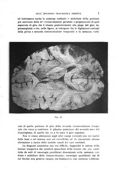 Rivista sperimentale di freniatria e medicina legale delle alienazioni mentali organo della Società freniatrica italiana