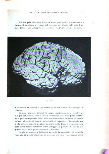 Rivista sperimentale di freniatria e medicina legale delle alienazioni mentali organo della Società freniatrica italiana