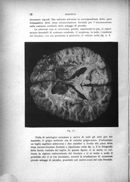 Rivista sperimentale di freniatria e medicina legale delle alienazioni mentali organo della Società freniatrica italiana