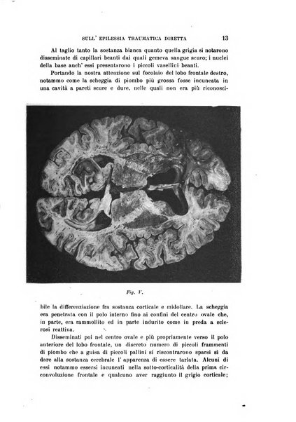 Rivista sperimentale di freniatria e medicina legale delle alienazioni mentali organo della Società freniatrica italiana