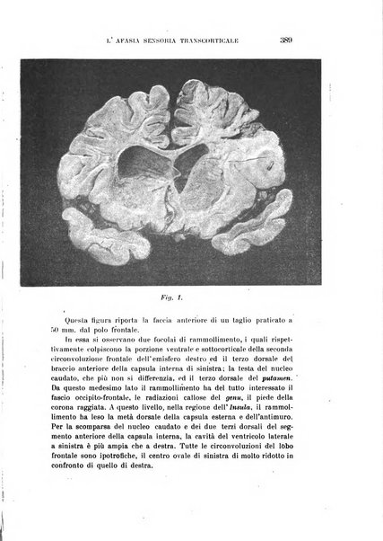 Rivista sperimentale di freniatria e medicina legale delle alienazioni mentali organo della Società freniatrica italiana