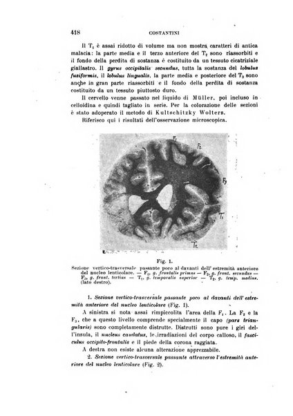 Rivista sperimentale di freniatria e medicina legale delle alienazioni mentali organo della Società freniatrica italiana