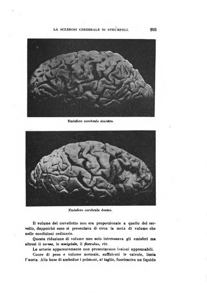 Rivista sperimentale di freniatria e medicina legale delle alienazioni mentali organo della Società freniatrica italiana