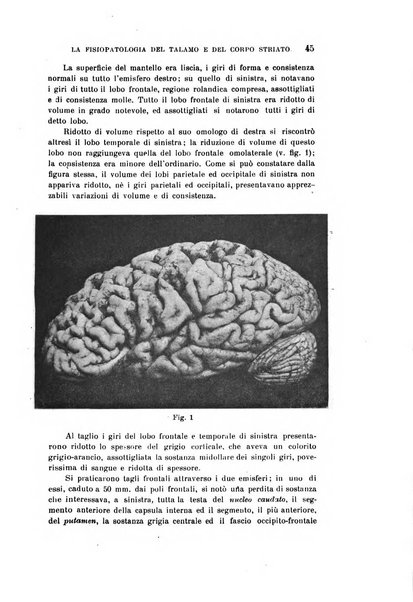 Rivista sperimentale di freniatria e medicina legale delle alienazioni mentali organo della Società freniatrica italiana