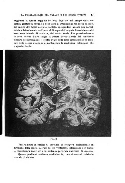 Rivista sperimentale di freniatria e medicina legale delle alienazioni mentali organo della Società freniatrica italiana