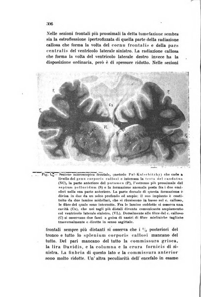 Rivista sperimentale di freniatria e medicina legale delle alienazioni mentali organo della Società freniatrica italiana