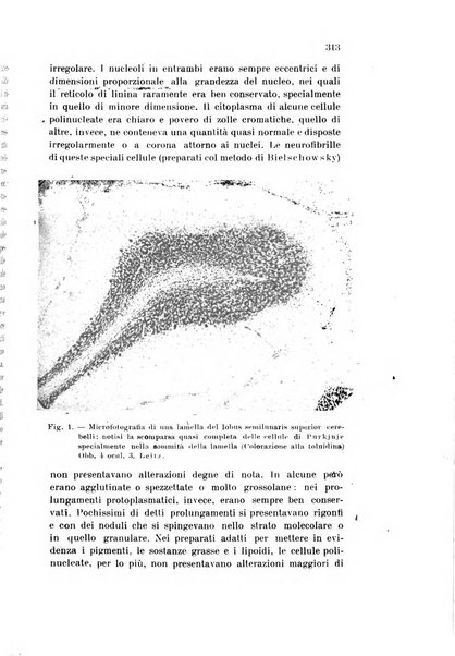 Rivista sperimentale di freniatria e medicina legale delle alienazioni mentali organo della Società freniatrica italiana