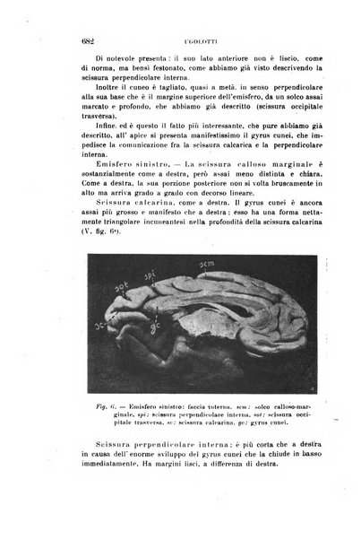 Rivista sperimentale di freniatria e medicina legale delle alienazioni mentali organo della Società freniatrica italiana