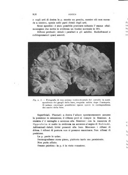 Rivista sperimentale di freniatria e medicina legale delle alienazioni mentali organo della Società freniatrica italiana