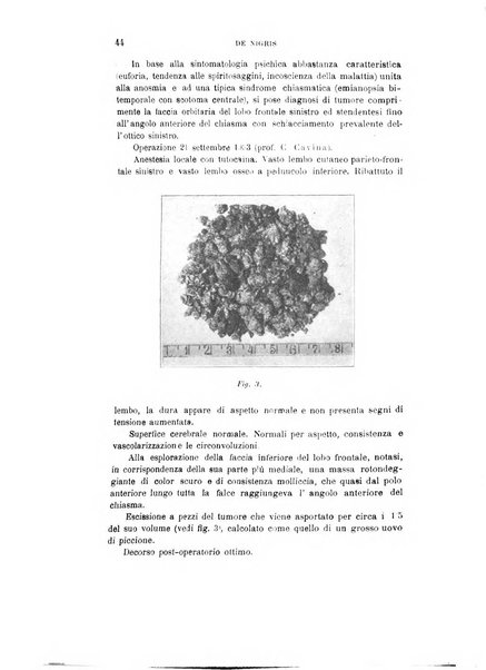 Rivista sperimentale di freniatria e medicina legale delle alienazioni mentali organo della Società freniatrica italiana