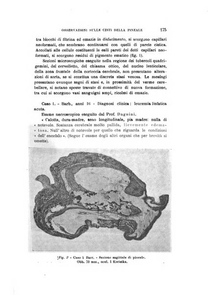 Rivista sperimentale di freniatria e medicina legale delle alienazioni mentali organo della Società freniatrica italiana