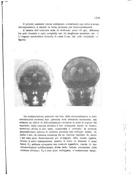 Rivista sperimentale di freniatria e medicina legale delle alienazioni mentali organo della Società freniatrica italiana