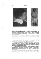 giornale/PUV0028278/1937/unico/00000088